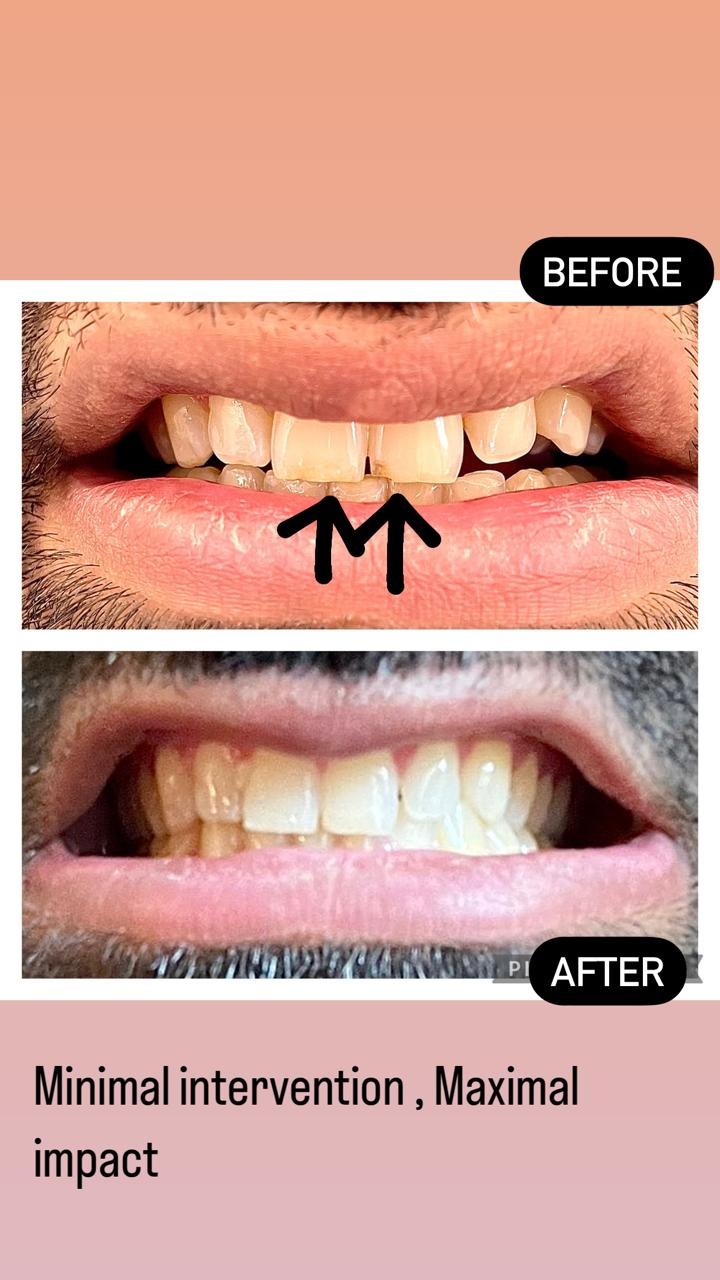 Cosmetic Dental Services clinical image 3