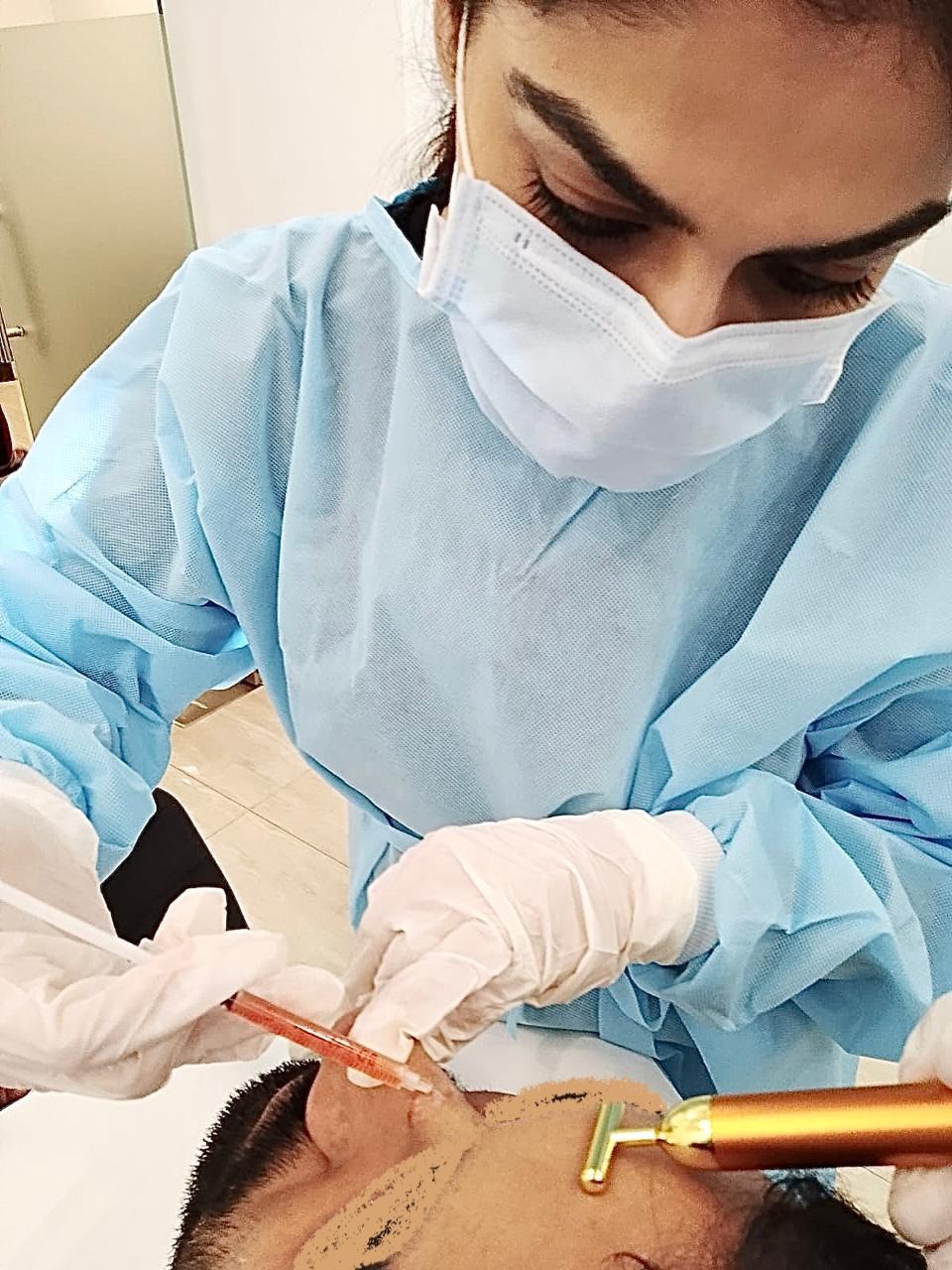 PRF for Skin Rejuvenation, Dark Circles, Hyperpigmentation, Hand & Neck, PRP + Growth Factors Therapy, Exosomes, Microneedling clinical image 1